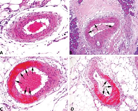 —hematoxylin And Eosin Hande Staining Of Mesenteric Arteries From Rats