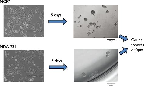 Mammosphere Formation Assay From Human Breast Cancer Tissues And Cell Lines Protocol