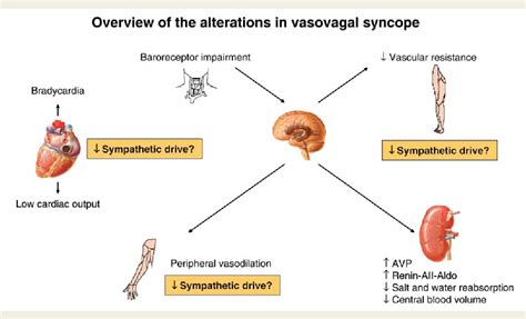 Vasovagal Syncope 中文 Silicon