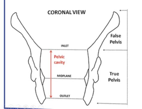 Pelvis And Perineum Lecture Flashcards Quizlet