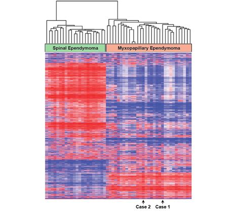 Unsupervised Clustering Of Dna Methylation Data Performed For Case 1 Download Scientific