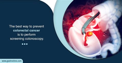 Colon and Rectal Cancer Screening - Dr. Harsh J Shah