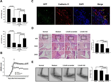 Amelioration Of Experimental Autoimmune Arthritis Through Targeting Of