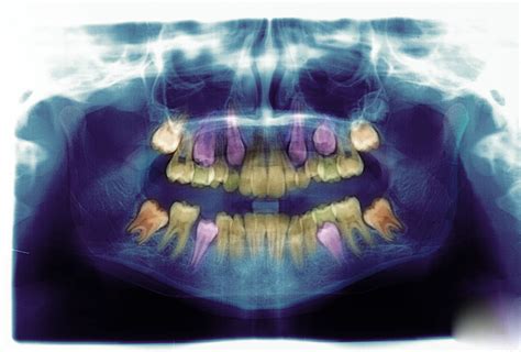 A Career In Forensic Radiography And Post Mortem Imaging