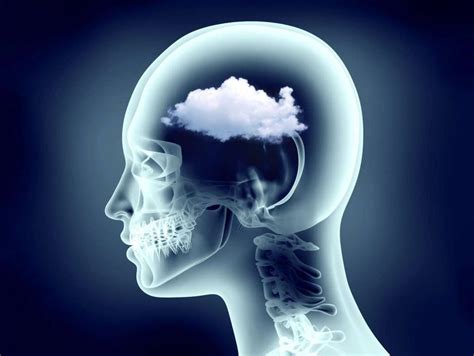 What Are The Causes Of Foggy Brain? - Ideal Post