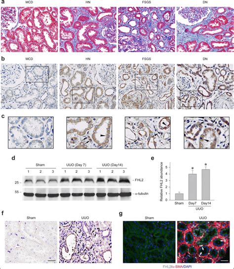 Fhl Is Induced In Fibrotic Kidneys From Both Human Ckds And Mice With