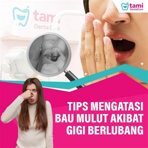 Tips Mengatasi Bau Mulut Akibat Gigi Berlubang Tami Dental Care Klinik Dokter Gigi Bandung