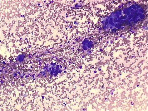 Centre de référence des microangiopathies thrombotiques