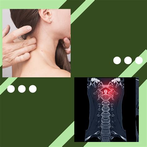 Best Ayurvedic Treatment For Cervical Spondylosis In Mumbai