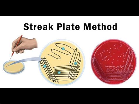 Bacterial Streak Plate