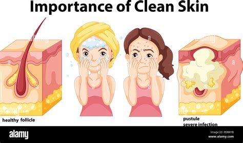 Importance Of Clean Skin Concept Illustration Stock Vector Image Art