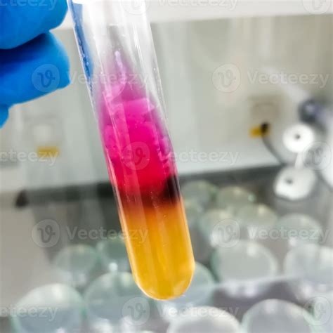 Salmonella Detection Method By Using Triple Sugar Iron Or TSI Agar In