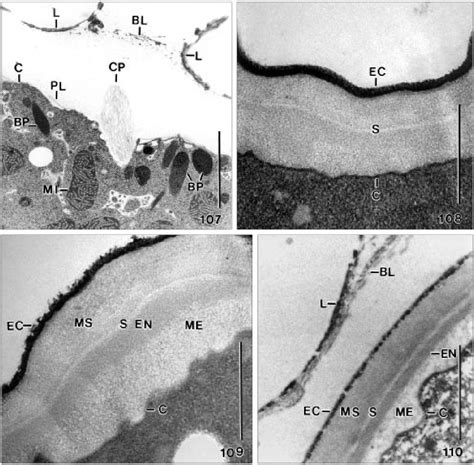 Figure 107 110 From The Unusual Lepidosome Coated Resting Cyst Of