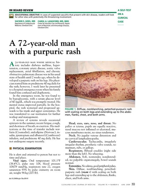 A 72 Year Old Man With A Purpuric Rash Cleveland Clinic Journal Of