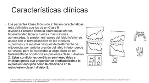 MAL OCLUSION CLASE II TRATAMIENTO INTERCEPTIVO Pptx