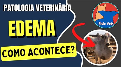 Edema mecanismos fisiopatológicos Patologia geral Medicina