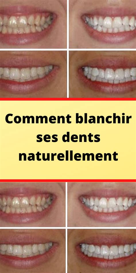 Comment Blanchir Ses Dents Naturellement Artofit