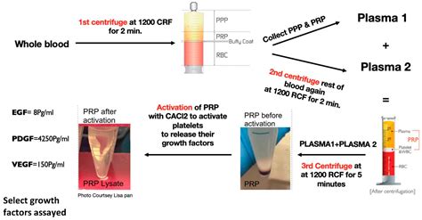 Bioengineering Free Full Text Platelet Rich Plasma Lysate