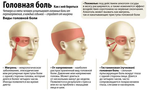 Головные боли при остеохондрозе, лечения головной боли мигрени ...