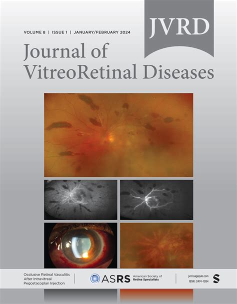 Retinal Vasculitis After Intravitreal Pegcetacoplan Report From The