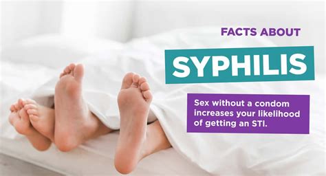 Secondary Syphilis Causes Symptoms Diagnosis 49 Off