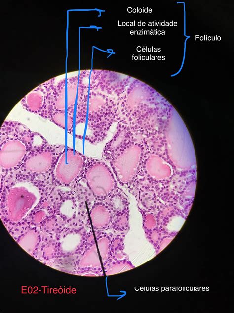 Tireóide Células parafoliculares e Folículo Histologia I