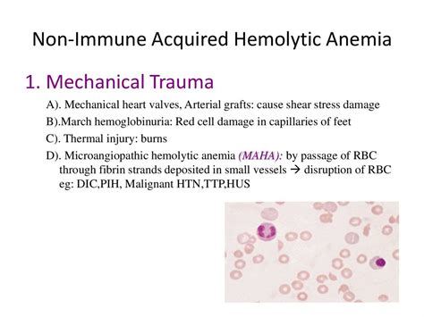 Hemolytic Anemia Classification