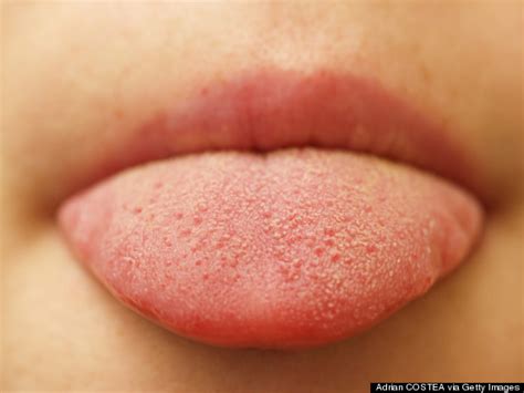 8 Things You Probably Didn't Know About Your Tongue | HuffPost Life