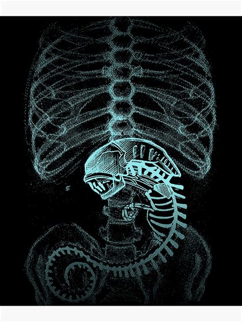 "Alien' Radiography', X-Ray vintage" Poster for Sale by KYRADEVLIN ...