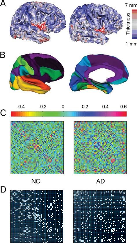 A Flowchart For The Construction Of Structural Cortical Networks A