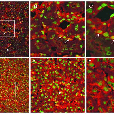 Indirect Immunofluorescence Micrographs Showing Interstitial Cells Of