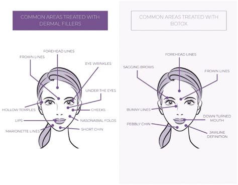 Whats The Difference Between Botox And Dermal Fillers