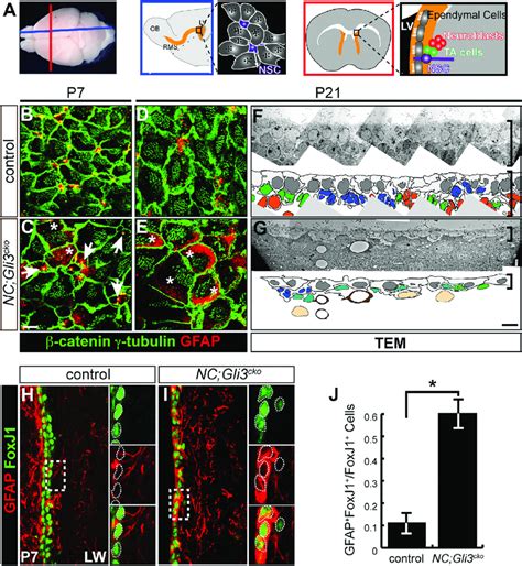 Gli3 Is Required For Proper Establishment Of The Neurogenic Niche In