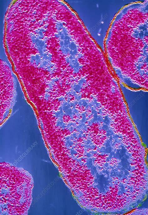 False Colour Tem Of E Coli Bacteria Stock Image B