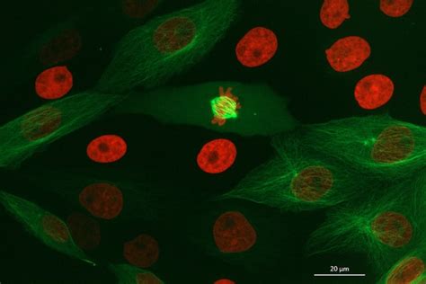 How to See the Cell Cycle Through Your Microscope - Bitesize Bio