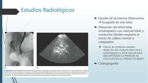 Cancer De Vesicula Y Via Biliar Ppt