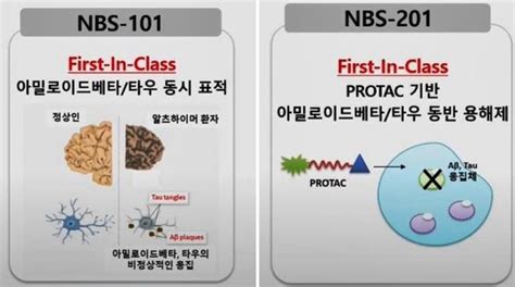 Medigate News 환자들 재활 치료하다 안타까운 마음직접 알츠하이머 치매 치료제 개발 나선 의사