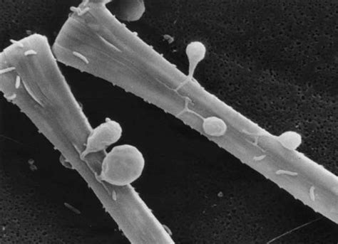 1. Scanning electron micrograph of zoospores (small spheres) and ...