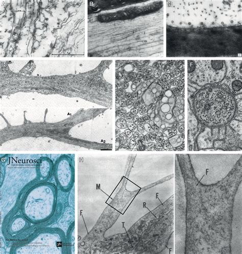 Cytoskeleton Microscope