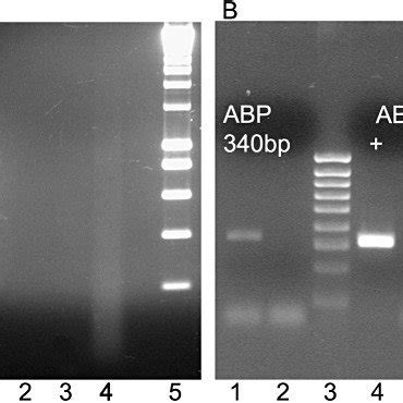 Influence Of Paraffin And Optimal Cutting Temperature Oct Embedding