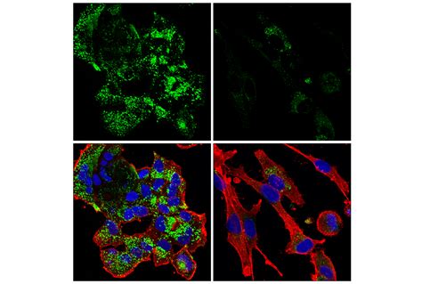 Cathepsin D E V H Rabbit Mab Cell Signaling Technology