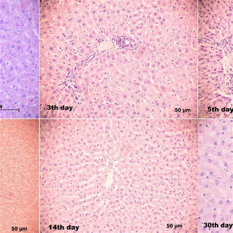 Histological Sections Of The Spleen After Hemostasis Using Cold Plasma