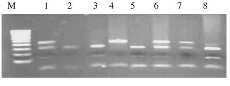 Mspa1 Restriction Fragments Of Cyp17 Alleles Separated By Agarose Gel