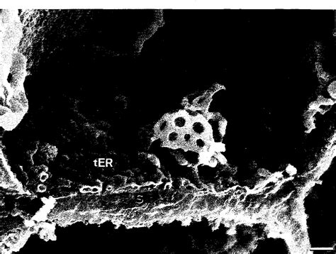 Figure From Scanning Electron Microscopy Of The Septal Pore Cap Of