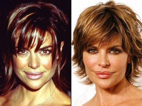 Lisa Rinna Before And After Using Botox Celebrity Plastic Surgery Online