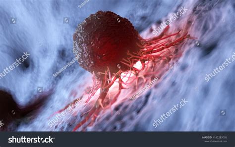 3d Rendered Illustration Human Cancer Cell Stock Illustration 1192283005 Shutterstock