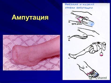 Презентация на тему: "НАРУШЕНИЯ ПЕРИФЕРИЧЕСКОГО КРОВООБРАЩЕНИЯ. ЛЕКЦИЯ ...