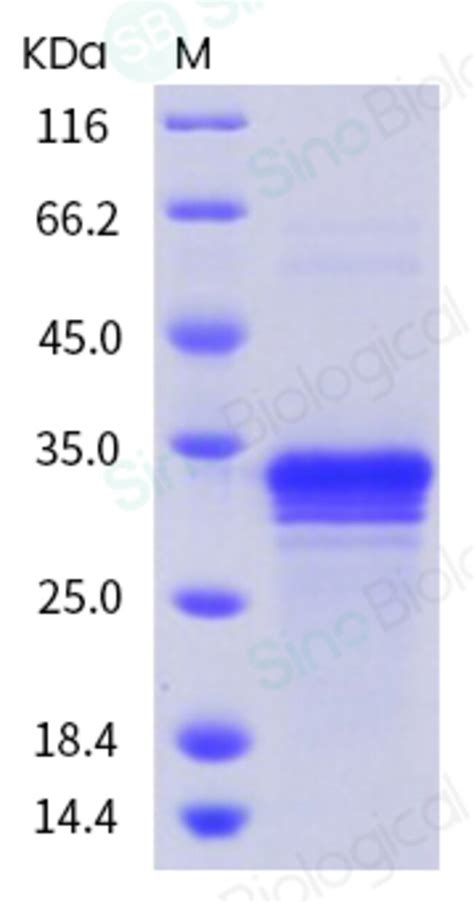 Sino Biological Human Hmgb Hmg Protein His Tag Ug Quantity