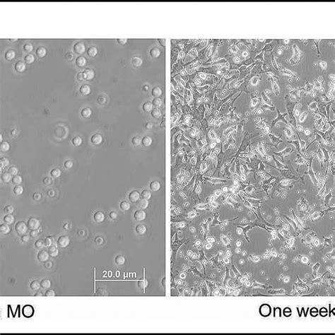 Morphologic Aspect Of Bone Marrow Cell Culture Fresh Bone Marrow Cells