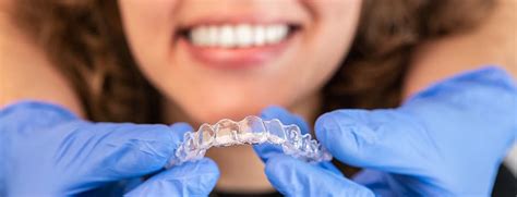 Aligners as a modern method of treating orthodontic problems — Alexandr ...